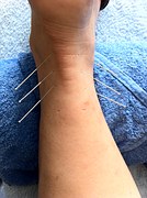 Sports Injuries 2